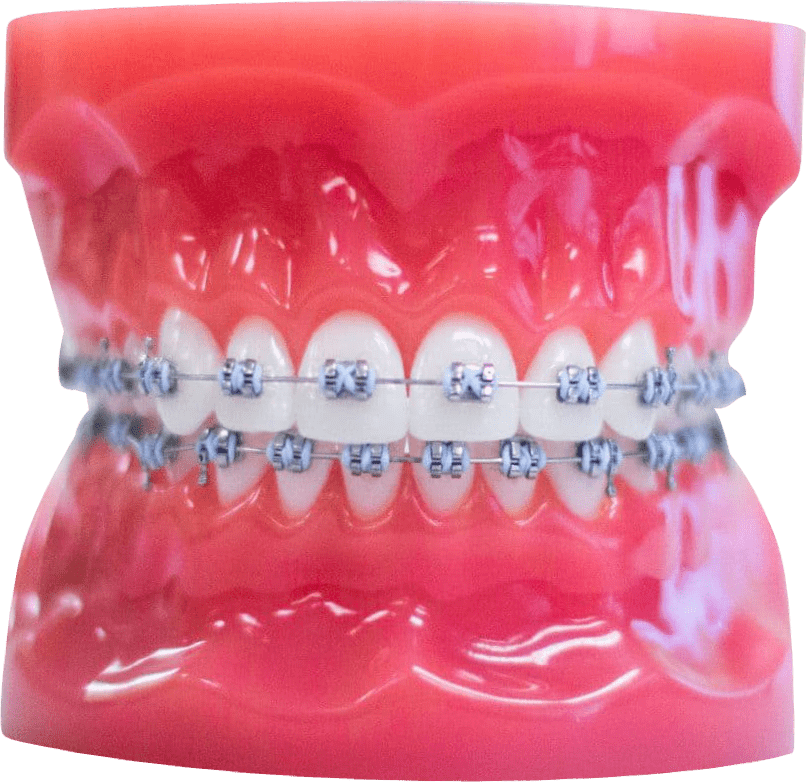 orthodontist office murfreesboro