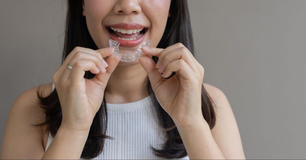 5 Tips for Braces and Clear Aligners
